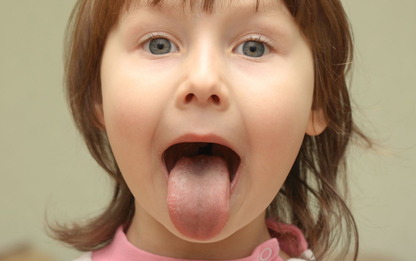 Tongue Thrust Speech Therapy 2 tongue thrust speech therapy
